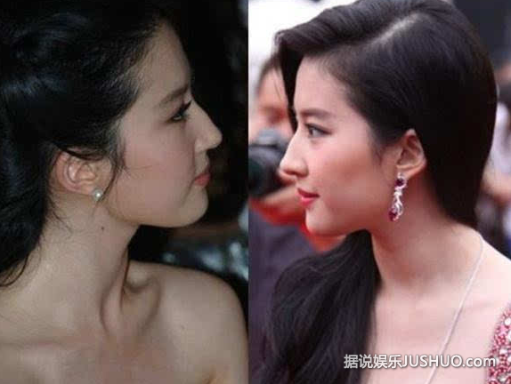 刘亦菲被曝整容？天生丽质也要靠整容？