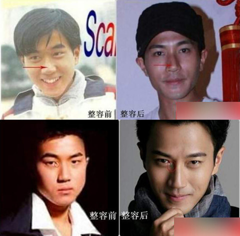 杨幂刘恺威被称假脸夫妇 二人整容前后对比照公开