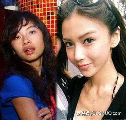 angelababy整容前后照片曝光 为证明原装愿医院验明正身