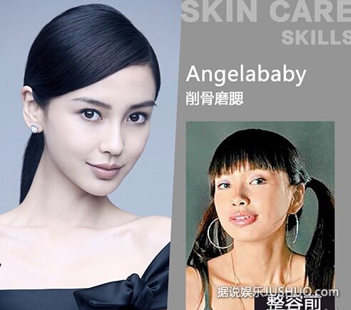 angelababy整容前照片曝光 丑小鸭变天鹅