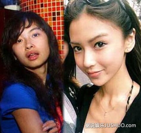 angelababy整容前后 照片曝光 为证明原装愿医院验明正身 angelababy整容前后 照片曝光 为证明原装愿医院验明正身