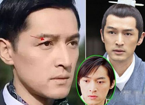 胡歌车祸前后照片对比图 整容费用超过百万