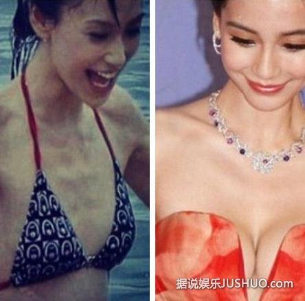 angelababy隆胸?揭女明星隆胸疑团 angelababy隆胸?揭女明星隆胸疑团