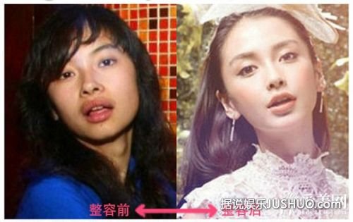 angelababy 整容前后对比照全曝光 黄晓明坚信：她没整容