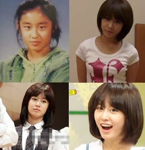 tara成员整容图对比曝光 整容技术堪称第一