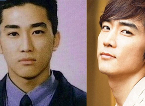 宋承宪整容前后对比照曝光 容貌差距太大恍似金秀贤