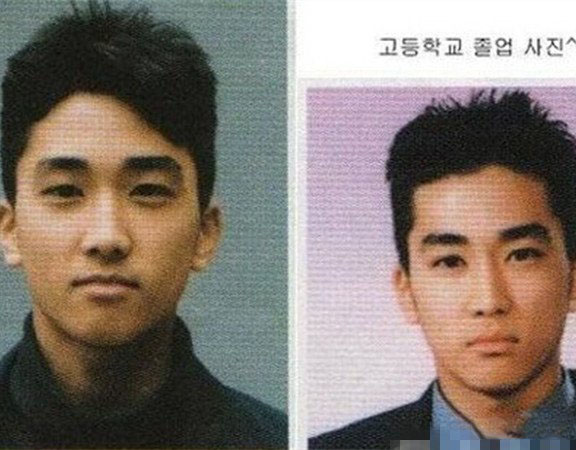 宋承宪整容前后对比照曝光 容貌差距太大恍似金秀贤