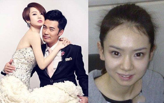 《爱情回来了》女主戚薇整容前后差别惊人