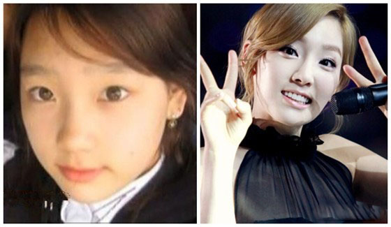金泰妍边伯贤分手了吗 少女时代金泰妍整容前原来长这样！