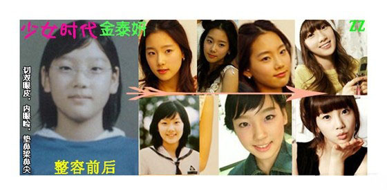 金泰妍边伯贤分手了吗 少女时代金泰妍整容前原来长这样！