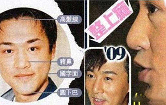 《卫子夫》电视剧热播 林峰整容前后照曝光被指鼻太假