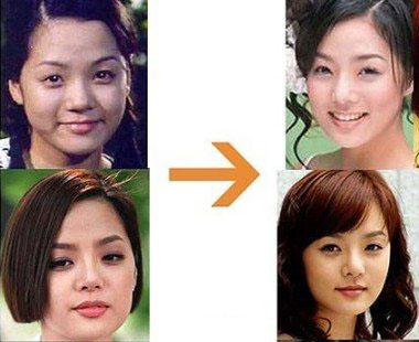 蔡琳整容前后的照片曝光 蔡琳整容失败后欲自杀