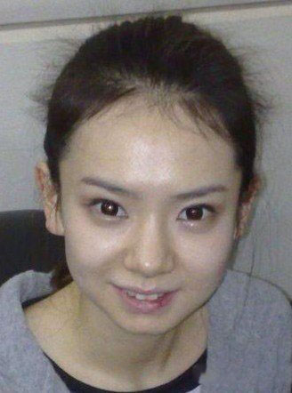 李承铉女友戚薇整容前后照片曝光