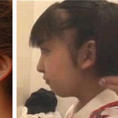 板野友美整容前照片曝光 网友惊叹脸变太多 板野友美整容前照片曝光 网友惊叹脸变太多