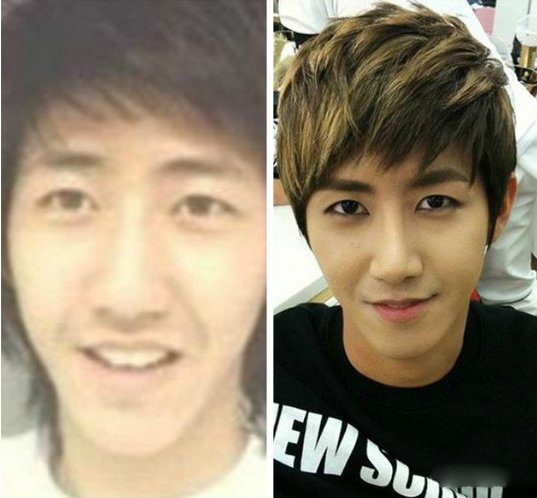 黄光熙整容前照片大曝光 韩国偶像主动公开整容事实