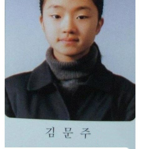 瑞雨整容前后照片对比 瑞雨是不是整容失败