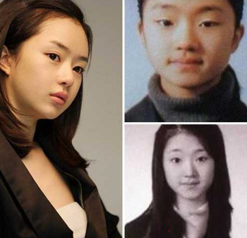 瑞雨整容前后照片对比 瑞雨是不是整容失败