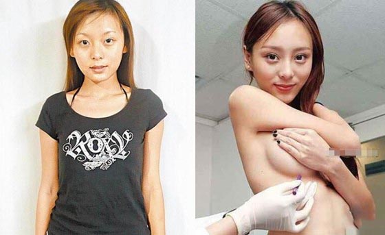 嫩模何佩瑜爆乳拍广告 何佩瑜承认整鼻隆胸割双眼皮