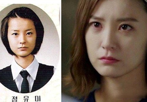 郑柔美整容前后照对比 揭郑有美个人资料 郑柔美整容前后照对比 揭郑有美个人资料