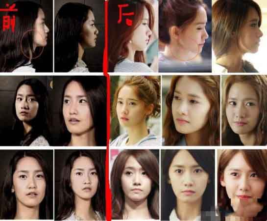 少女时代允儿整容前不忍直视图片 被称“只惊不艳”