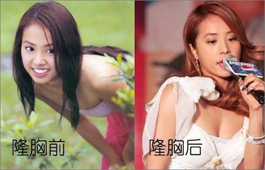 蔡依林隆胸过吗 蔡依林隆胸前后对比照曝光