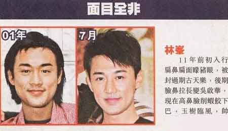 林峰整容前后照片 整容后玉树临风帅甲无线 林峰整容前后照片 整容后玉树临风帅甲无线