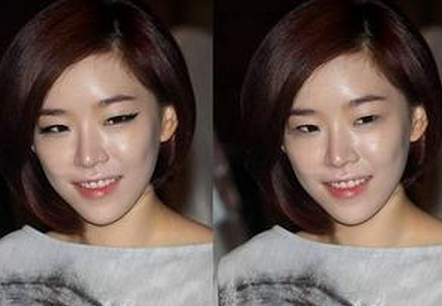 孙佳仁素颜照片 看看孙佳仁整容了吗