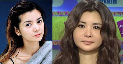 张瑞希整容前照片 张瑞希整容前后对比照片曝光 张瑞希整容前照片 张瑞希整容前后对比照片曝光