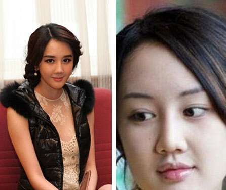 文梦洋整容前后亲妈不敢认 文梦洋整容后遗症浮现 文梦洋整容前后亲妈不敢认 文梦洋整容后遗症浮现