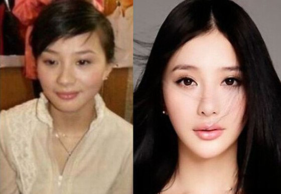 明星整容前后照片,明星整容前后照片图片