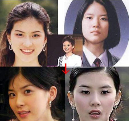 李宝英整容前后照对比 李宝英个人资料及近照曝光 李宝英整容前后照对比 李宝英个人资料及近照曝光