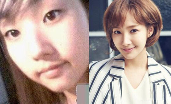 韩剧《Remember》热播 女主朴敏英整容前后照片曝光 韩剧《Remember》热播 女主朴敏英整容前后照片曝光