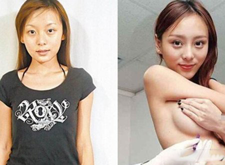 何佩瑜整容前照片曝光 其曾经公开承认过整容