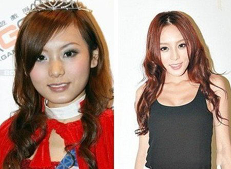 何佩瑜整容前照片曝光 其曾经公开承认过整容