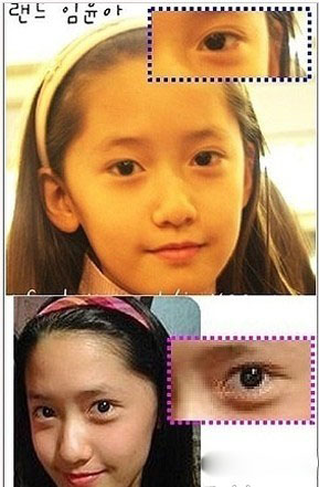 允儿整容前素颜惊悚 看过还爱才是真粉 允儿整容前素颜惊悚 看过还爱才是真粉