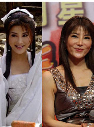 昔日杨丽菁整容前后对比 网友叹相见不如怀念 昔日杨丽菁整容前后对比 网友叹相见不如怀念