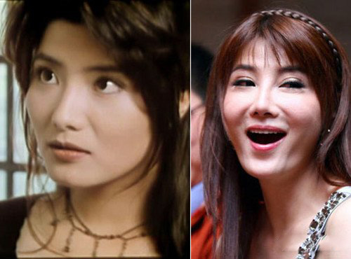 昔日杨丽菁整容前后对比 网友叹相见不如怀念 昔日杨丽菁整容前后对比 网友叹相见不如怀念