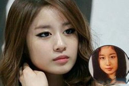 朴智妍整容前照片曝光 网曝其人整容后判若两人 朴智妍整容前照片曝光 网曝其人整容后判若两人
