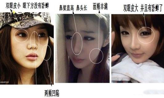 2ne1朴春承认整容 美女变面瘫惨被传吸毒
