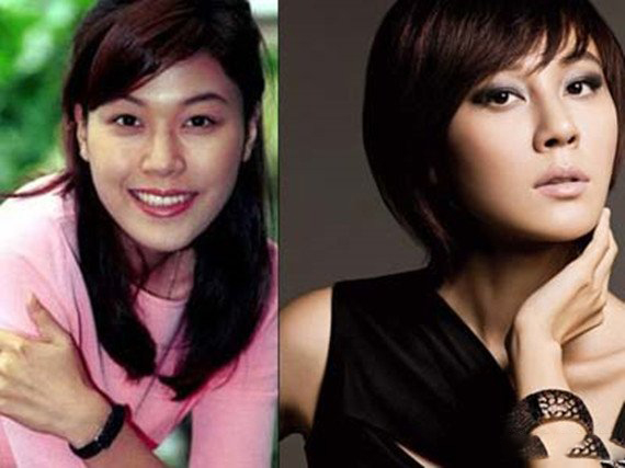 曝金荷娜整容前后照片 被疑隆鼻容貌十分惊悚