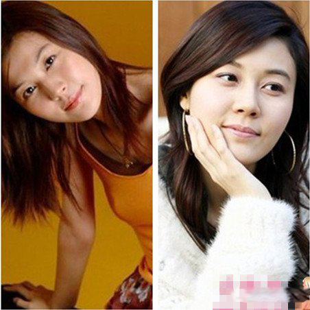 曝金荷娜整容前后照片 被疑隆鼻容貌十分惊悚