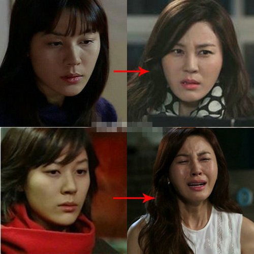 曝金荷娜整容前后照片 被疑隆鼻容貌十分惊悚