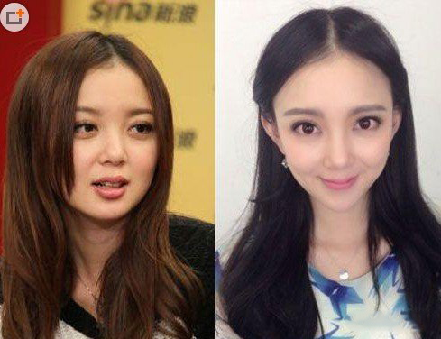 汪小敏整容前后照片曝光 个人资料大揭秘