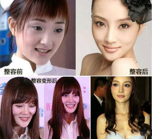 李小璐整容失败照片 面部僵硬尽显老态 李小璐整容失败照片 面部僵硬尽显老态