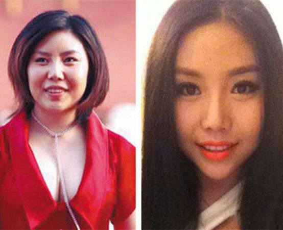 超女尚雯婕纪敏佳整容前后对比 相差甚大不到像本人