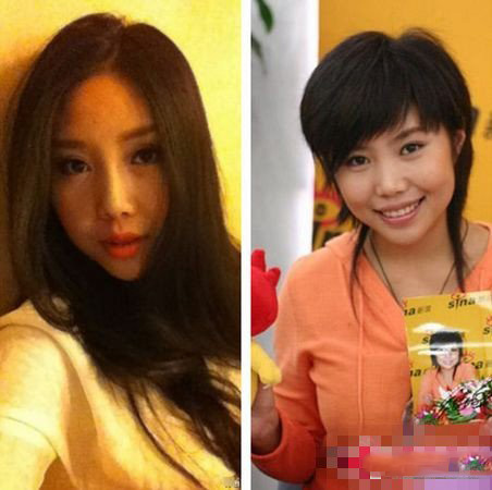 超女尚雯婕纪敏佳整容前后对比 相差甚大不到像本人