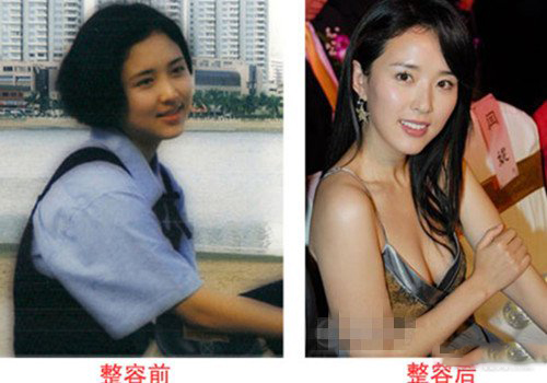 揭秘颜丹晨整容前后 整容前后判若两人 揭秘颜丹晨整容前后 整容前后判若两人