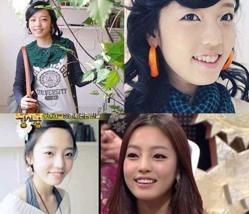 曝kara具荷拉整容前后照 样貌变化非常大