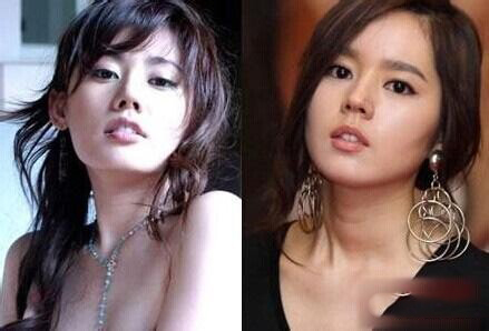 秋瓷炫整容了吗 秋瓷炫整容前后对比照片
