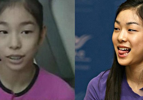 金妍儿整容前后对比照曝光 花滑女王早年容貌让网友接受不了